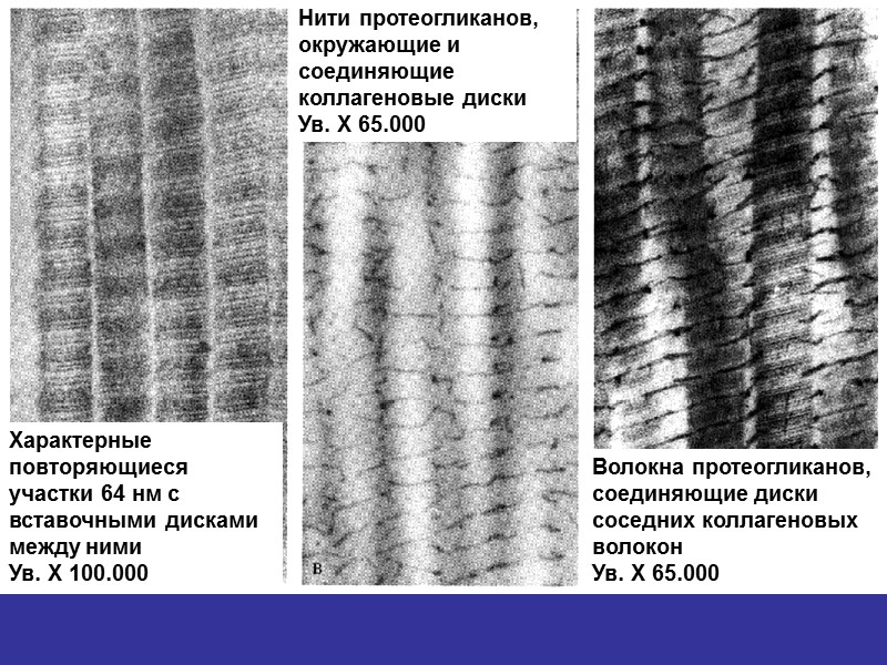 Характерные повторяющиеся участки 64 нм с вставочными дисками между ними Ув. Х 100.000 Нити